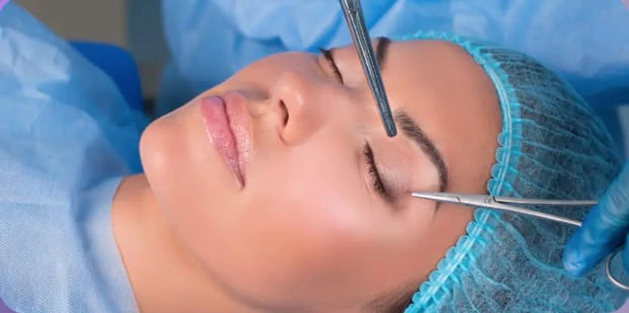 عملية تجميل الجفون